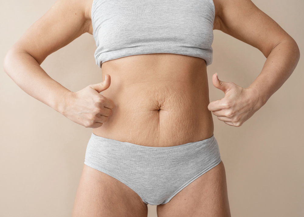 is tummy tuck right for me