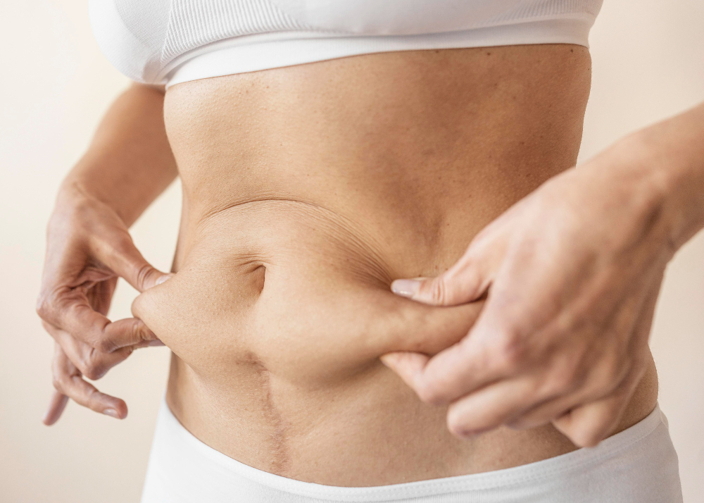 Abdominoplasty in Birmingham